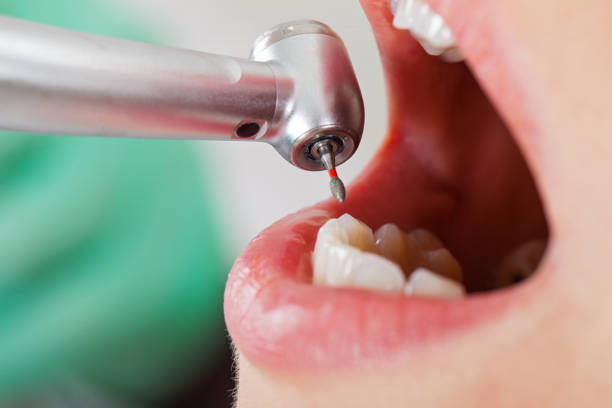 Best Emergency Dental Services for Seniors in Rowlett, TX